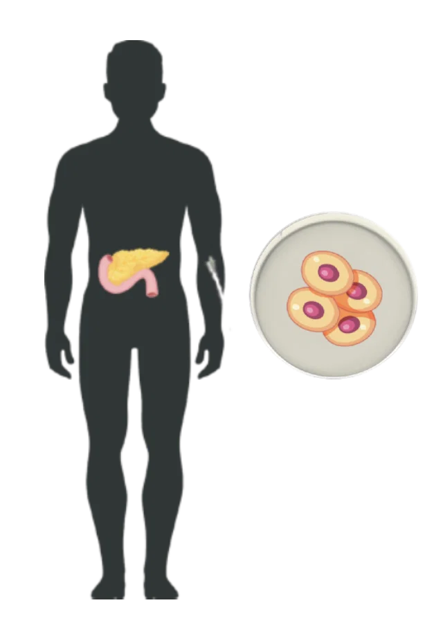 Donor pancreas illustration